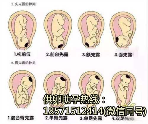 试管婴儿助孕费用明细？北京试管婴儿医院排行榜 北京助孕妈妈到哪里找